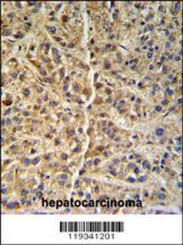 GNS Antibody (Center S298)