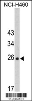 FKBP14 Antibody (N-term)
