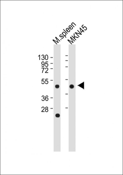 CTSE Antibody (Center)