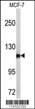 PSA Antibody (C-term)