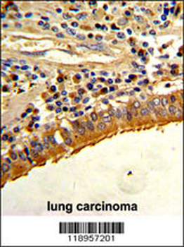 SPP1 Antibody (C-term)