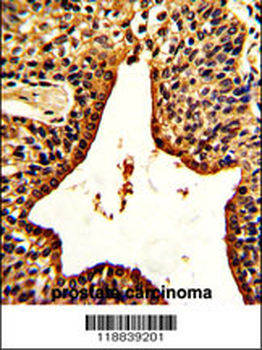 VIP Antibody (C-term)
