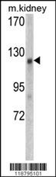 WTX Antibody (Center)