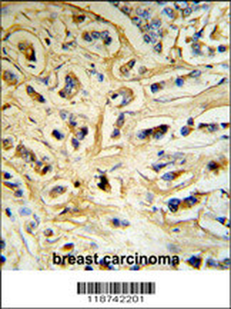 CASA Antibody (Center)