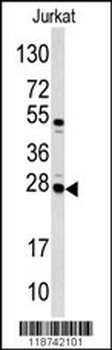 CASA Antibody (Center)