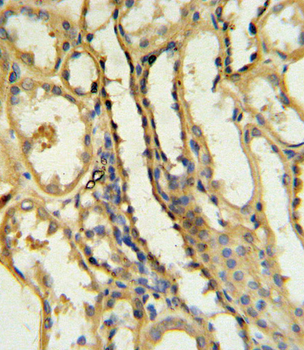 TRAP Antibody (N-term)
