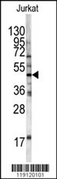 HFE Antibody (Center)