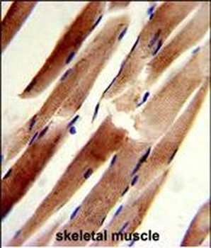 ACTR2 Antibody (C-term)