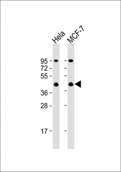 ACTR2 Antibody (C-term)