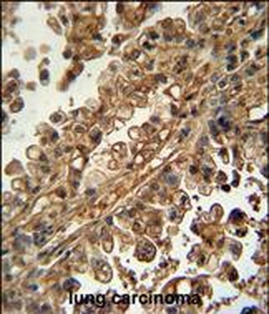 ABCG1 Antibody (N-term)