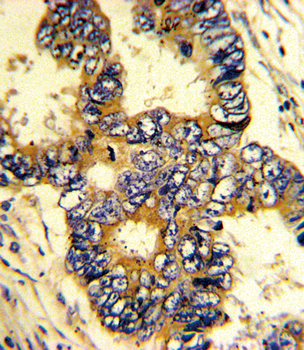 EPN3 Antibody (N-term)