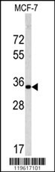 EMD Antibody (C-term)