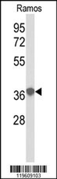 EEF1D Antibody (N-term)