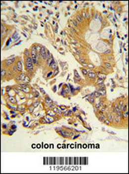 CLNS1A Antibody (Center)