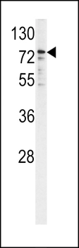 P450R Antibody (Center)