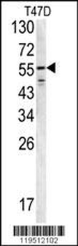 FIBB Antibody (N-term)
