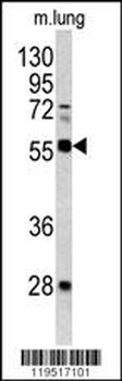 FLI1 Antibody (Center)