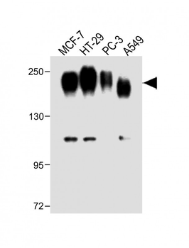 CEA Antibody (Center)