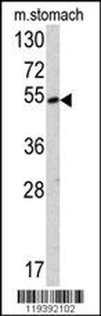 SUV4-20H2 Antibody (Center)