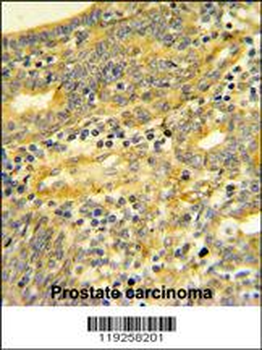 DPP8 Antibody (C-term)