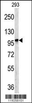 DPP8 Antibody (C-term)