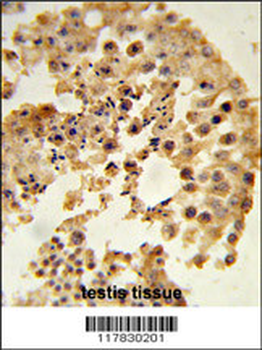 DPP8 Antibody (N-term)