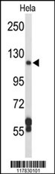 DPP8 Antibody (N-term)
