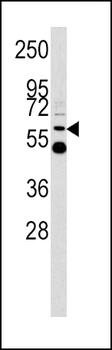 UDB17 Antibody (Center)