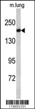 ALS2 Antibody (C-term)