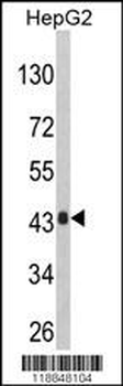 AGXT Antibody (Center)