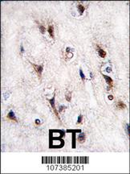 NURR1 (NR4A2) Antibody (N-term)