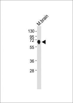 NURR1 (NR4A2) Antibody (N-term)