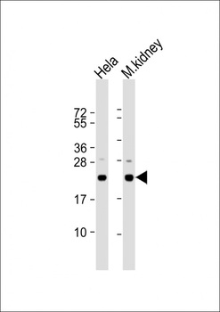 DJ-1 Antibody (N-term)