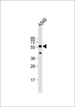 PINK1 (PARK6) Antibody (N-term T133)