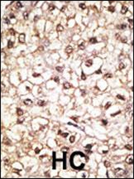 Parkin Antibody (C-term)