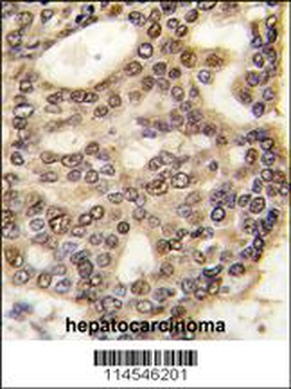 HDGF Antibody (C-term)
