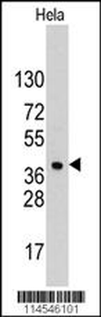 HDGF Antibody (C-term)