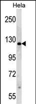 PARP1 Antibody (N-term)