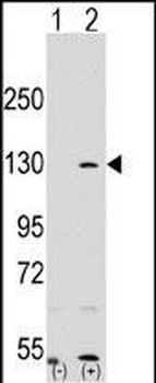 PARP1 Antibody (N-term)