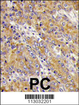 Myosin 1C (MYO1C) Antibody (C-term)