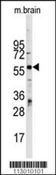 ZBTB7B Antibody (Center)
