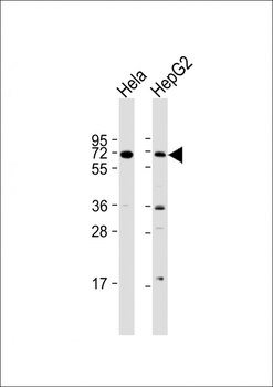 ZBTB7B Antibody (C-term)