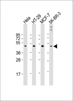 RAD9 Antibody (Center L265)