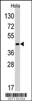 RAD9 Antibody (Center L265)