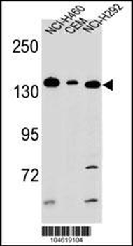 Metabotropic Glutamate Receptor 1 Antibody (C-term)