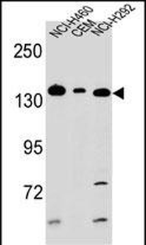 Metabotropic Glutamate Receptor 1 Antibody (C-term)