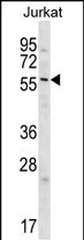Glypican 3 (GPC3) Antibody (C-term)