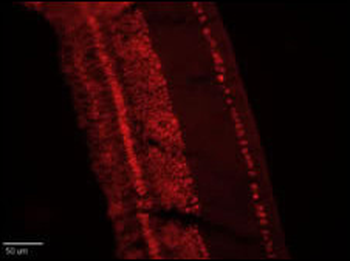 CLC4 Antibody (C-term)