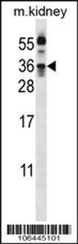 Kallikrein 8 Antibody (Center)