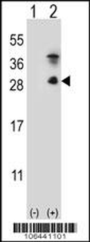 Kallikrein 7 Antibody (C-term)